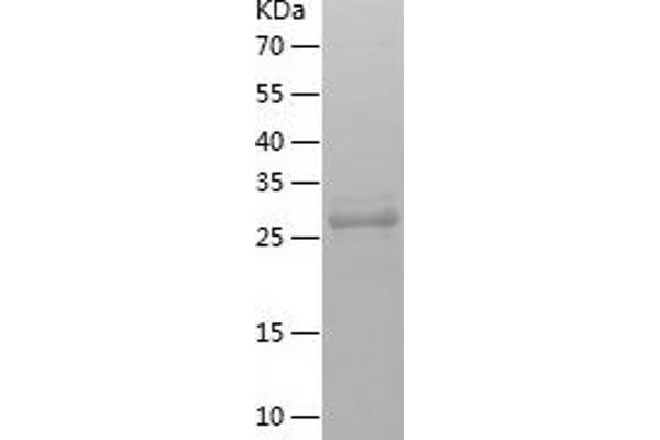 RPA2 Protein (AA 1-270) (His tag)