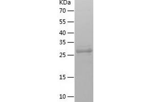 Western Blotting (WB) image for Replication Protein A2, 32kDa (RPA2) (AA 1-270) protein (His tag) (ABIN7124827) (RPA2 Protein (AA 1-270) (His tag))