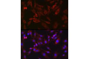 Immunofluorescence (IF) image for anti-Bradykinin Receptor B1 (BDKRB1) (AA 1-100) antibody (ABIN7265910)