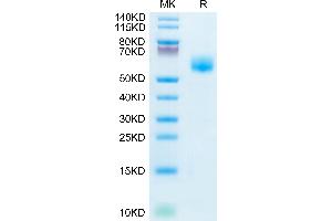 IL1RL1 Protein (AA 19-328) (His tag)