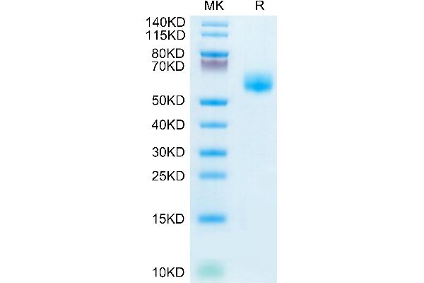 IL1RL1 Protein (AA 19-328) (His tag)