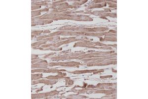 Immunohistochemical analysis of (ABIN392043 and ABIN2841811) on paraffin-embedded Human heart tissue.