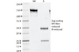 SDS-PAGE Analysis Purified Thymidylate Synthase Mouse Monoclonal Antibody (TS106). (TYMS 抗体)