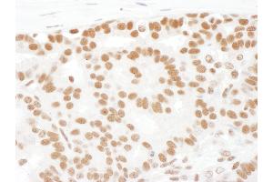 Immunohistochemistry (IHC) image for anti-Splicing Factor 1 (SF1) (AA 25-75) antibody (ABIN7453644)