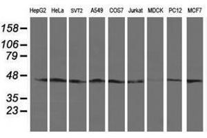 Image no. 2 for anti-serpin Peptidase Inhibitor, Clade B (Ovalbumin), Member 13 (SERPINB13) antibody (ABIN1500878) (SERPINB13 抗体)
