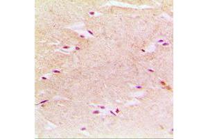 Immunohistochemical analysis of PEX14 staining in human muscle formalin fixed paraffin embedded tissue section. (PEX14 抗体  (Center))