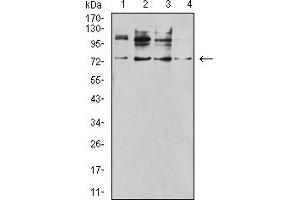 Western Blotting (WB) image for anti-Tumor Necrosis Factor Receptor Superfamily, Member 1B (TNFRSF1B) (AA 23-257) antibody (ABIN7193267)