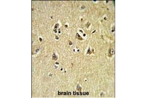 Immunohistochemistry (Paraffin-embedded Sections) (IHC (p)) image for anti-Vacuolar Protein Sorting 53 Homolog (VPS53) (AA 111-140), (N-Term) antibody (ABIN652486)