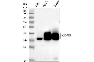 Western blot analysis of CD79b using anti-CD79b antibody (ABIN3043398). (CD79b 抗体  (AA 29-229))