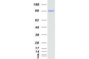 Western Blotting (WB) image for Ephrin Type A Receptor 1 (EPHA1) protein (Myc-DYKDDDDK Tag) (ABIN2720225)
