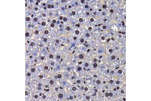 Immunohistochemistry of paraffin-embedded mouse liver using FIP1L1 antibody at dilution of 1:100 (x400 lens). (FIP1L1 抗体)