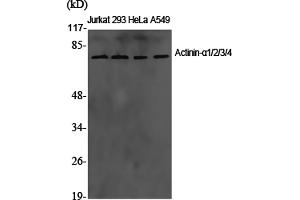 Western Blotting (WB) image for anti-Actinin, alpha 1/2/3/4 (ACTN1/ACTN2/ACTN3/ACTN4) antibody (ABIN5960682) (ACTN1/2/3/4 抗体)