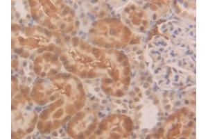 Immunohistochemistry (IHC) image for anti-Superoxide Dismutase 1, Soluble (SOD1) (AA 2-154) antibody (ABIN7429214)