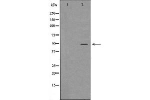 Western blot analysis of Hela whole cell lysates, using RBBP4 Antibody. (Retinoblastoma Binding Protein 4 抗体  (C-Term))