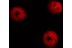 Immunofluorescence (fixed cells) (IF/ICC) image for anti-SRY (Sex Determining Region Y)-Box 9 (SOX9) (pSer181) antibody (ABIN6255043)