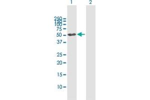 Western Blot analysis of GALNS expression in transfected 293T cell line by GALNS MaxPab polyclonal antibody. (GALNS 抗体  (AA 1-522))