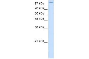 WB Suggested Anti-GRIA2 Antibody Titration:  2. (GRIA2 抗体  (N-Term))