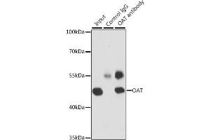Immunoprecipitation (IP) image for anti-Ornithine Aminotransferase (OAT) (AA 160-439) antibody (ABIN6144985)
