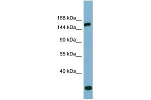 WB Suggested Anti-EPRS  Antibody Titration: 0. (EPRS 抗体  (Middle Region))