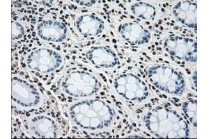 Immunohistochemical staining of paraffin-embedded colon tissue using anti-MAP2K4mouse monoclonal antibody. (MAP2K4 抗体)