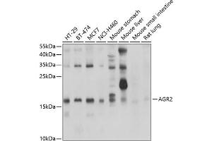 Western blot analysis of extracts of various cell lines, using  antibody (ABIN6131176, ABIN6136646, ABIN6136647 and ABIN6222857) at 1:1000 dilution. (AGR2 抗体  (AA 21-175))