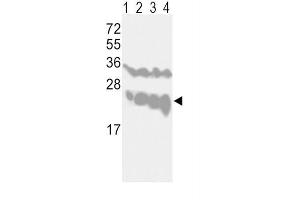 Western Blotting (WB) image for anti-Ubiquitin Carboxyl-terminal Esterase L1 (Ubiquitin Thiolesterase) (UCHL1) antibody (ABIN3001459)
