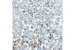 Immunohistochemistry of paraffin-embedded human liver using B-Raf Rabbit pAb (ABIN7265818) at dilution of 1:100 (40x lens). (BRAF 抗体  (AA 350-449))
