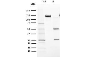 SDS-PAGE Analysis Purified Cytochrome P450 1A1/1A2 Mouse Monoclonal Antibody (MC1). (CYP1A1/2 抗体)
