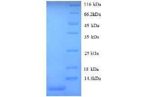 SDS-PAGE (SDS) image for Chemokine (C-X-C Motif) Ligand 1 (Melanoma Growth Stimulating Activity, Alpha) (CXCL1) (AA 29-96) protein (His tag) (ABIN1047114)