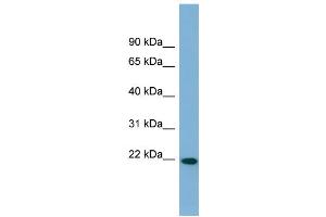 WB Suggested Anti-FNDC4 Antibody Titration:  0. (FNDC4 抗体  (Middle Region))