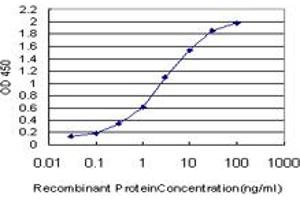 Detection limit for recombinant GST tagged SRF is approximately 0. (SRF 抗体  (AA 406-508))