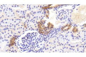 Detection of EFNB2 in Human Kidney Tissue using Polyclonal Antibody to Ephrin B2 (EFNB2) (Ephrin B2 抗体)