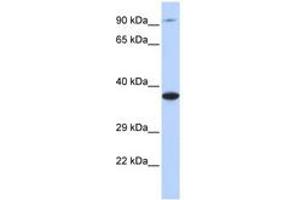 Image no. 1 for anti-Bardet-Biedl Syndrome 5 (BBS5) (C-Term) antibody (ABIN6741199)