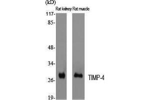 Western Blotting (WB) image for anti-TIMP Metallopeptidase Inhibitor 4 (TIMP4) (C-Term) antibody (ABIN3177728) (TIMP4 抗体  (C-Term))