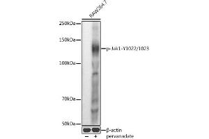 Western blot analysis of extracts of R. (JAK1 抗体  (pTyr1022, pTyr1023))