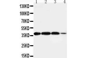 Anti-Arg2 antibody, Western blotting Lane 1: Rat Lung Tissue Lysate Lane 2: Rat Testis Tissue Lysate Lane 3: A549 Cell Lysate Lane 4:293T Cell Lysate