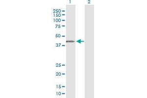 Western Blotting (WB) image for anti-Armadillo Repeat Containing, X-Linked 3 (ARMCX3) (AA 278-379) antibody (ABIN565635)