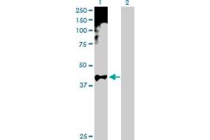 Western Blot analysis of HOXA11 expression in transfected 293T cell line by HOXA11 MaxPab polyclonal antibody. (Homeobox A11 抗体  (AA 1-313))