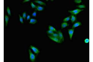 Immunofluorescent analysis of HepG2 cells using ABIN7171408 at dilution of 1:100 and Alexa Fluor 488-congugated AffiniPure Goat Anti-Rabbit IgG(H+L) (CD96 抗体  (AA 306-395))