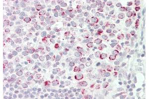 Immunohistochemistry (IHC) image for anti-Cleavage Stimulation Factor, 3' Pre-RNA, Subunit 2, 64kDa (CSTF2) (N-Term) antibody (ABIN2778764)