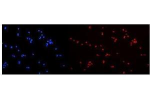 IF analysis of hnRNP A2B1 using anti-hnRNP A2B1 antibody (ABIN5692872). (HNRNPA2B1 抗体)