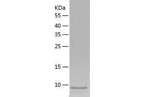 Western Blotting (WB) image for Lymphocyte Antigen 6 Complex, Locus G6D (LY6G6D) (AA 20-104) protein (His tag) (ABIN7123801) (LY6G6D Protein (AA 20-104) (His tag))