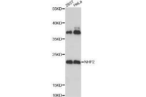 Western blot analysis of extracts of various cell lines, using NHP2 Antibody. (NHP2 抗体)