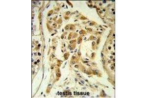 Immunohistochemistry (Paraffin-embedded Sections) (IHC (p)) image for anti-Espin (ESPN) (AA 17-45), (N-Term) antibody (ABIN652258)