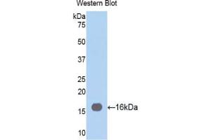 Western blot analysis of the recombinant protein. (Fascin 抗体  (AA 277-396))