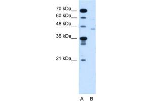 Western Blotting (WB) image for anti-Fukutin (FKTN) antibody (ABIN2464004) (Fukutin 抗体)