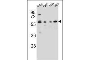 CEP70 Antibody (Center) (ABIN654603 and ABIN2844302) western blot analysis in WiDr,CHO,A549, cell line lysates (35 μg/lane). (CEP70 抗体  (AA 309-338))