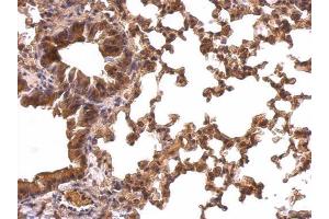 Immunohistochemistry (IHC) image for anti-Peroxiredoxin 1 (PRDX1) antibody (ABIN2855135)