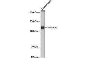 Western blot analysis of extracts of Mouse brain, using NMD Rabbit mAb (ABIN7267417) at 1:1000 dilution. (GRIN1/NMDAR1 抗体)