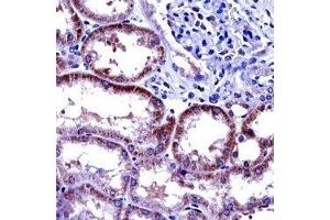 IL-6 antibody immunohistochemistry analysis in formalin fixed and paraffin embedded human kidney tissue. (IL-6 抗体  (AA 27-55))